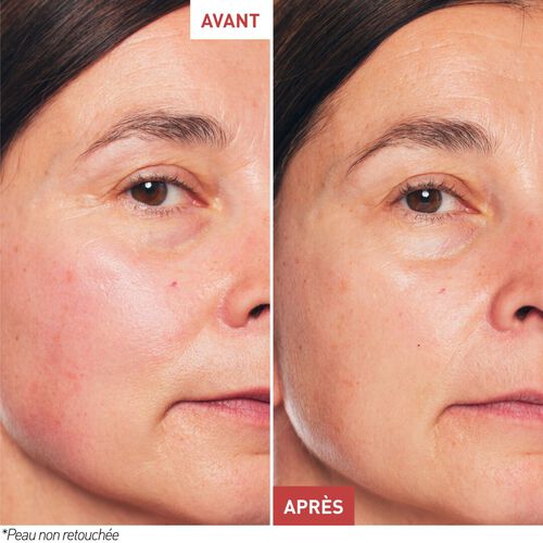 Agrandir la vue3/10 de Skin Therapy &ndash; Huile-S&eacute;rum Nuit Multi-Perfectrice, , FR
