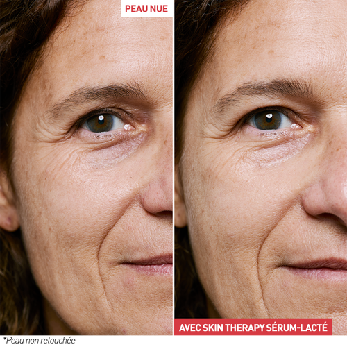 Agrandir la vue4/9 de Skin Therapy &ndash; S&eacute;rum Lact&eacute; Nuit Multi-Perfecteur, , FR